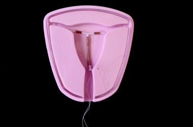 IUD intrauterine device